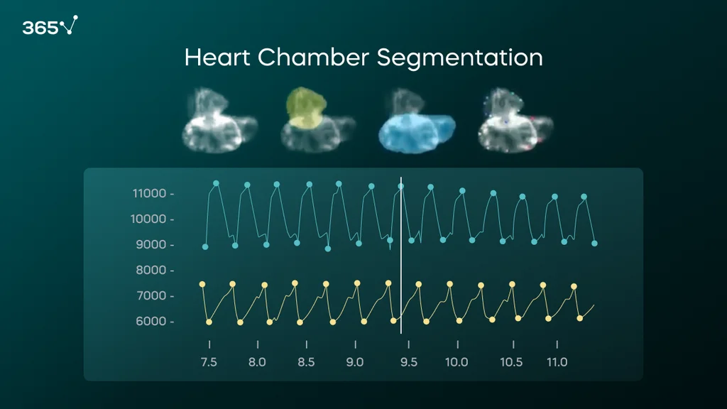 By training a DL model to segment the atrium (yellow) and the ventricle (blue), we can predict those structures in the video and extract heart physiological parameters, such as heart rate, arrhythmias, ejection fraction, etc.